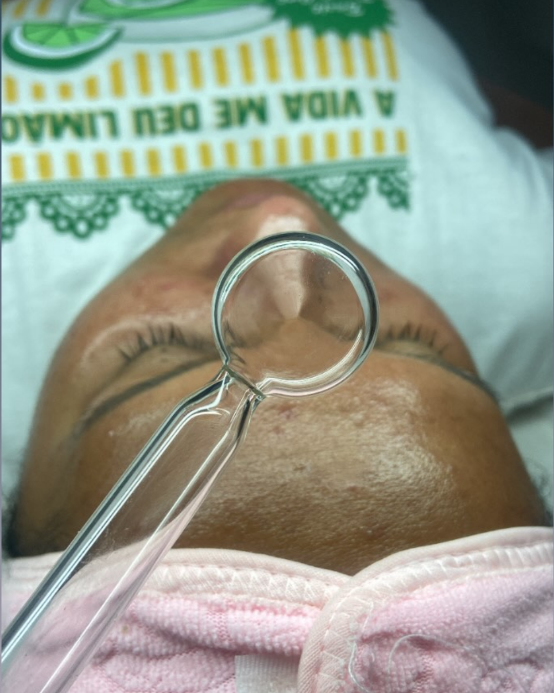 Limpeza de Pele